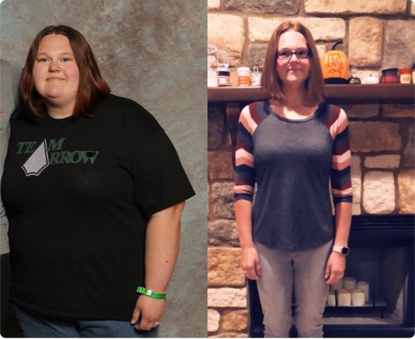 A before and after photo of West Texas Bariatrics patient Bena