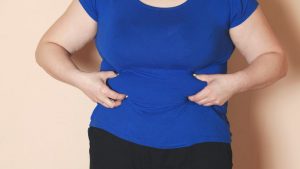 Is It Possible to Do Gastric Sleeve Surgery Twice?