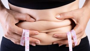 What Do I Do About Loose Skin After Bariatric Surgery?