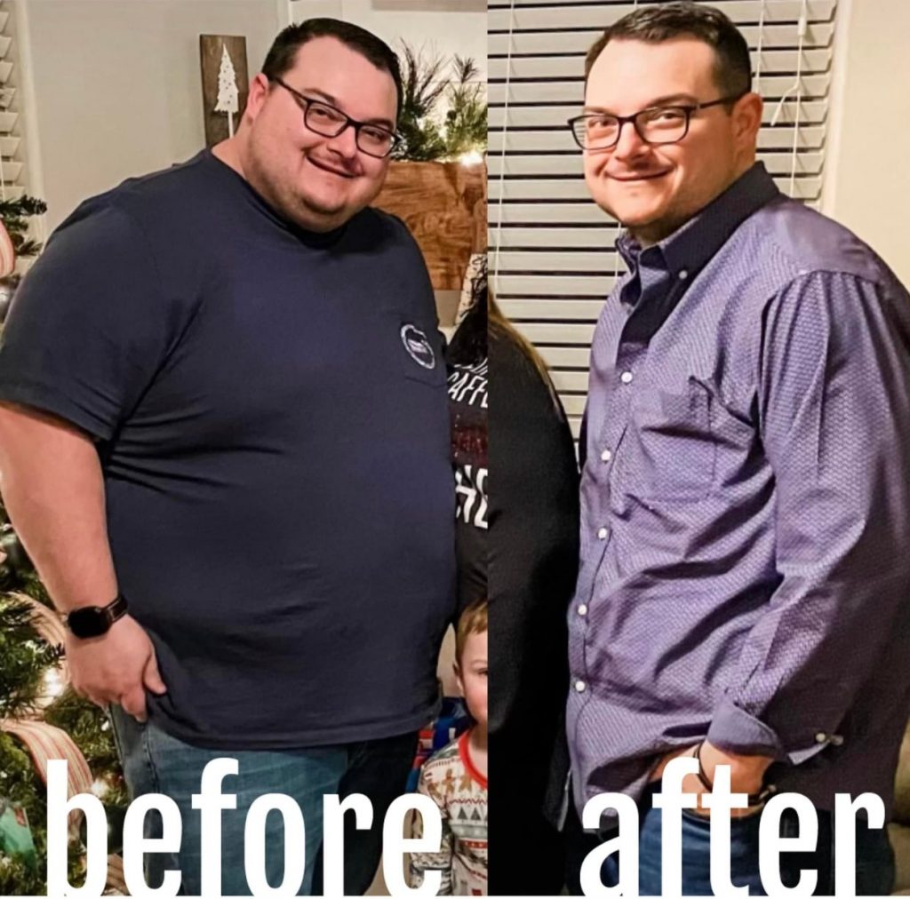 Where to Start Weight Loss in Lubbock, TX West Texas Bariatrics