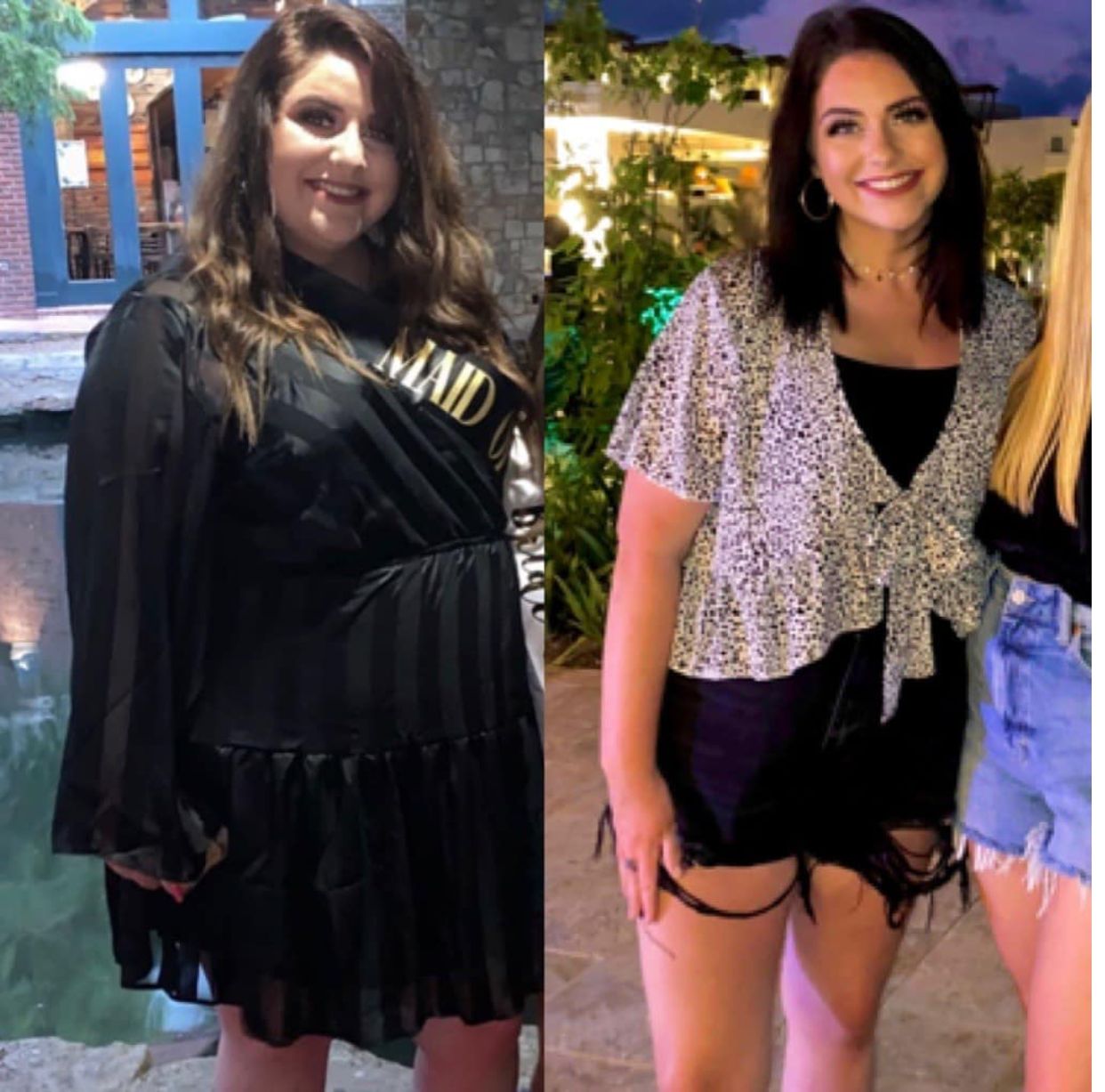 Patients' before and after photos from their bariatric surgery at West Texas Bariatrics.