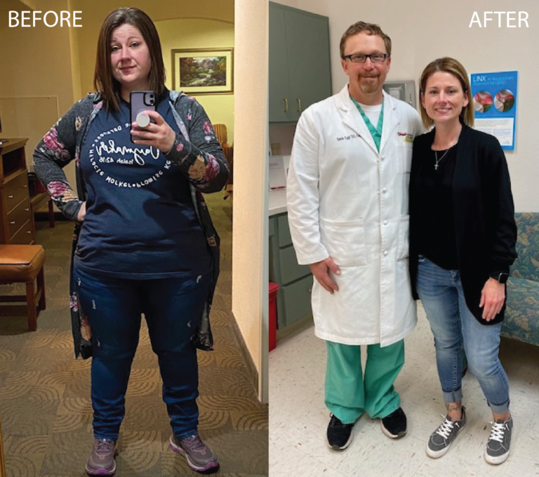 before and after of bariatric surgery at West Texas Bariatrics