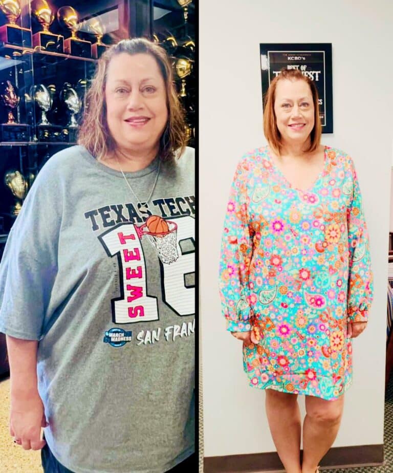 Before and After Photos of Michelle a West Texas Bariatrics Patient