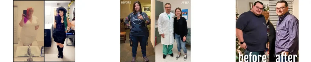 bariatric surgery before and after west texas bariatrics weight loss patients-01